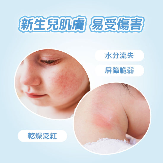BZU BZU 嬰兒退紅止癢舒緩凝膠 15g